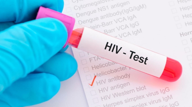 thông báo kết quả HIV dương tính thong bao ket qua hiv duong tinh