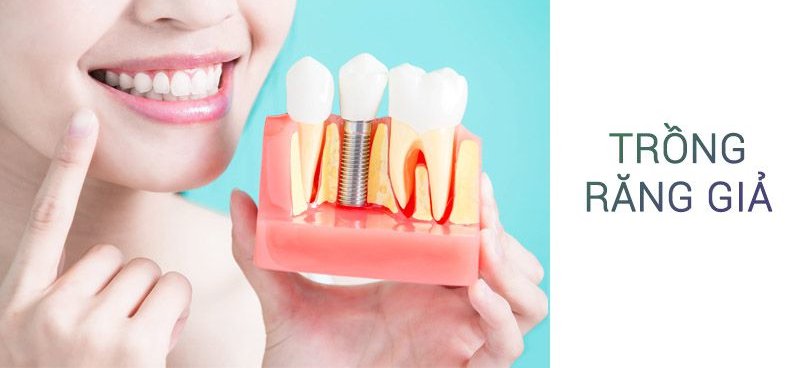 Trồng răng giả do tai nạn lao động có được trả tiền?